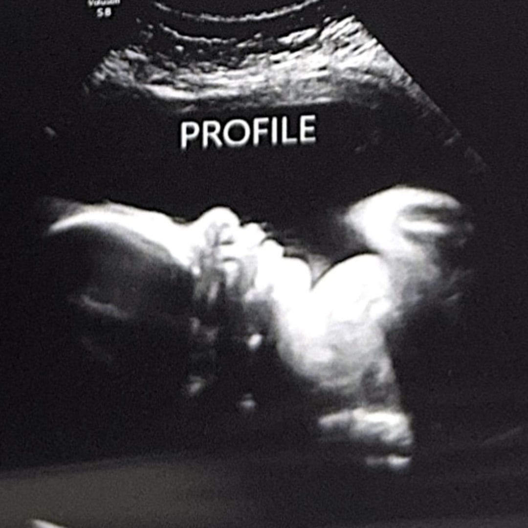 Photo shared by Bryce for their Babylist baby registry.