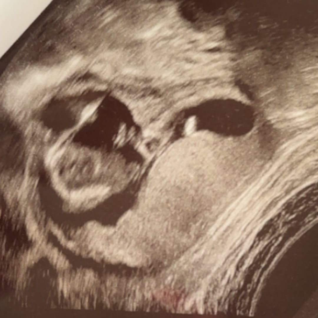 Photo shared by Cassie for their Babylist baby registry.