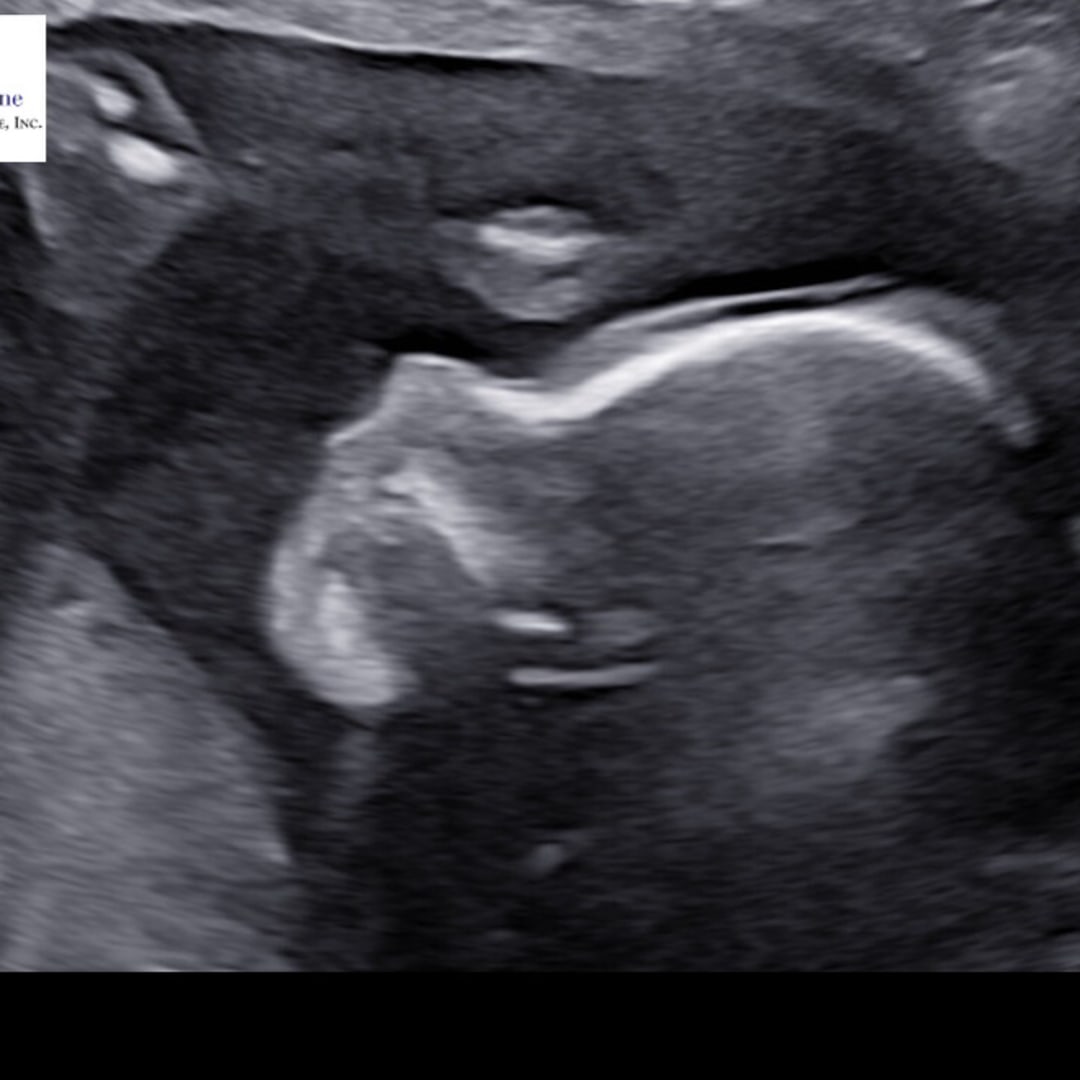 Photo shared by Katie for their Babylist baby registry.