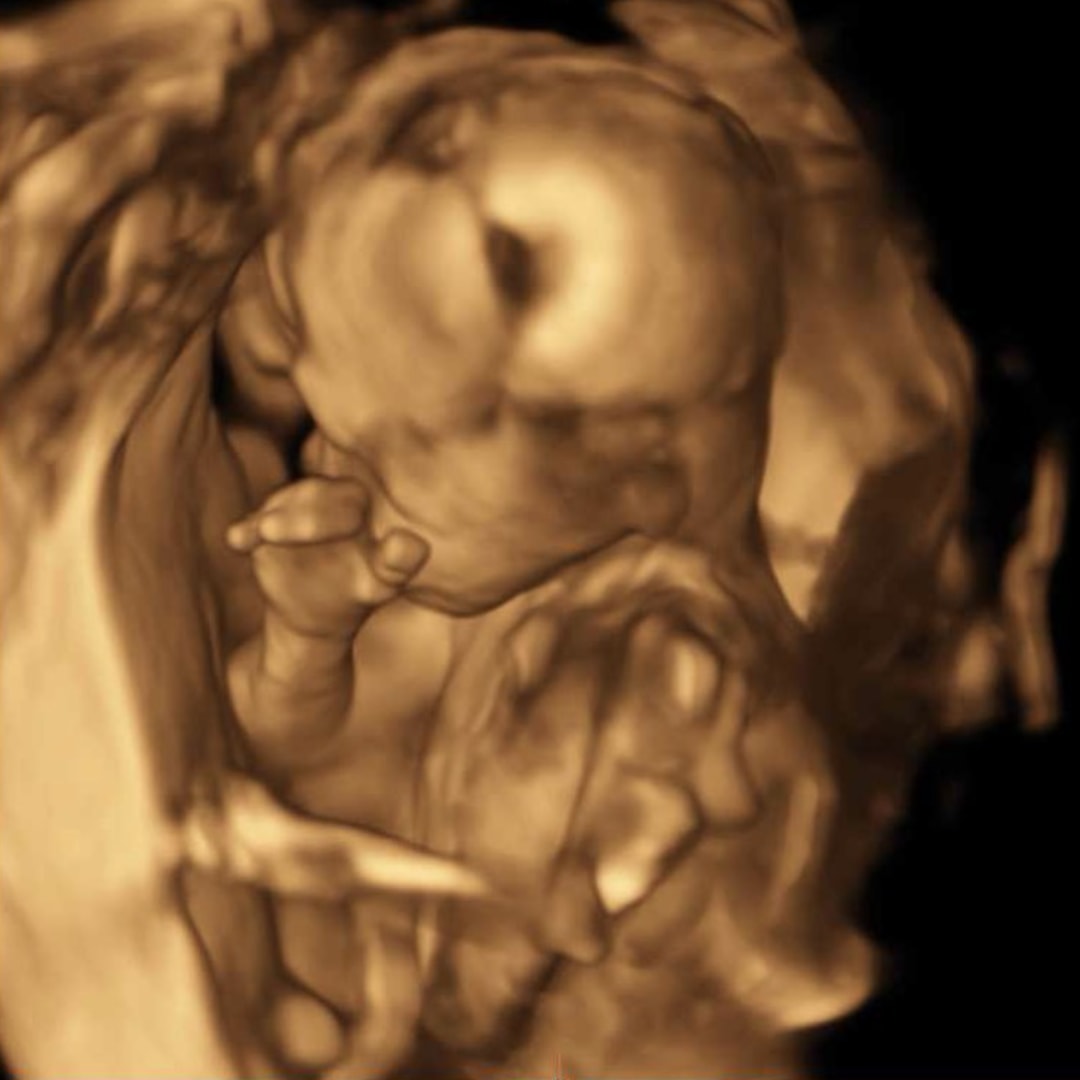 Photo shared by Caitlin for their Babylist baby registry.
