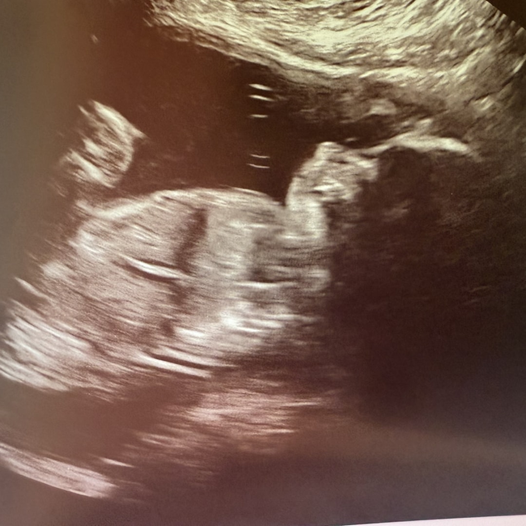 Photo shared by Kattie for their Babylist baby registry.