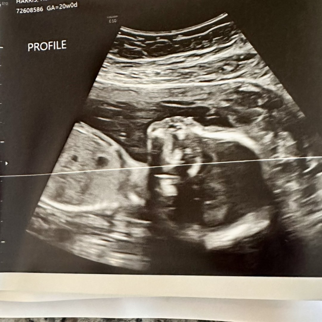 Photo shared by Heather for their Babylist baby registry.