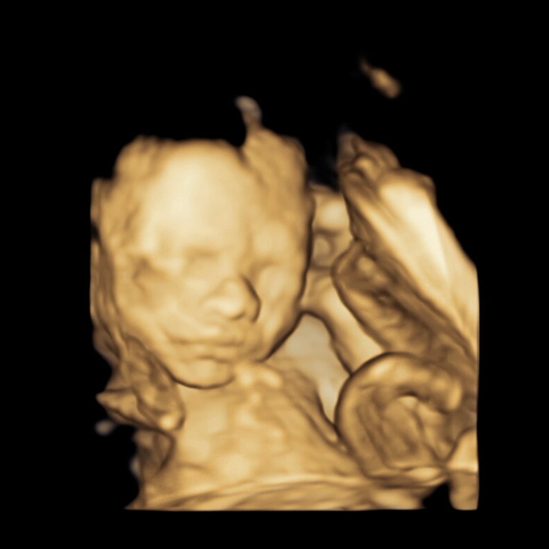 Photo shared by Karinn for their Babylist baby registry.