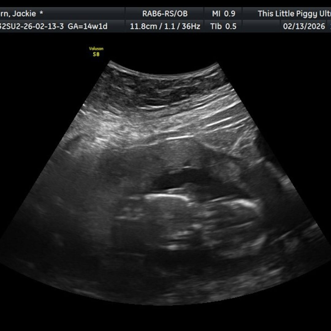 Photo shared by Jackie for their Babylist baby registry.