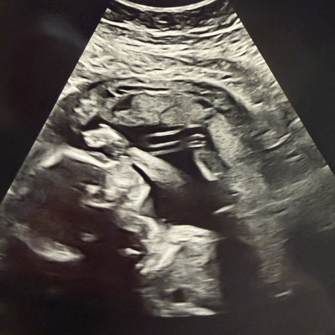 Photo shared by Megan for their Babylist baby registry.