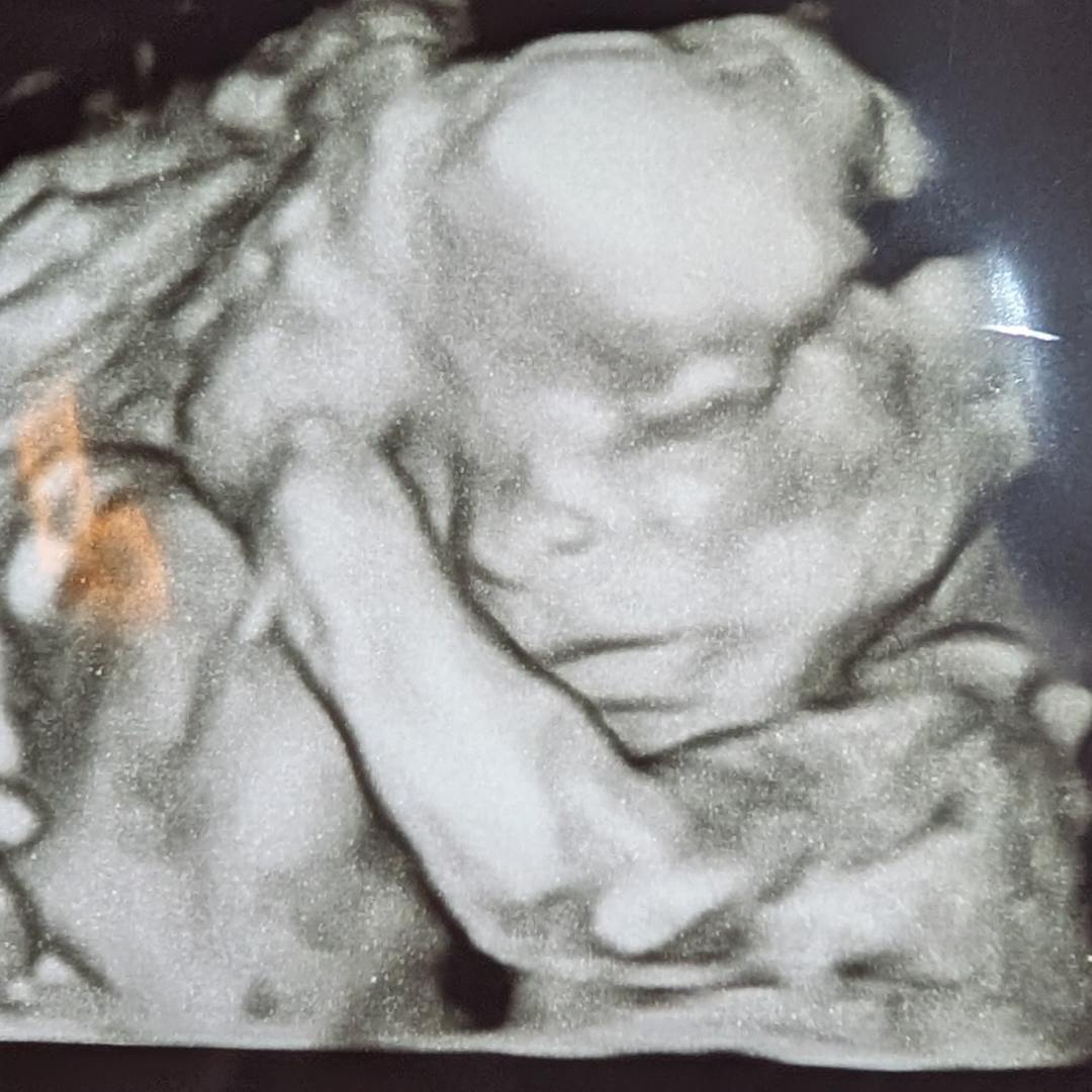 Photo shared by Caylee for their Babylist baby registry.