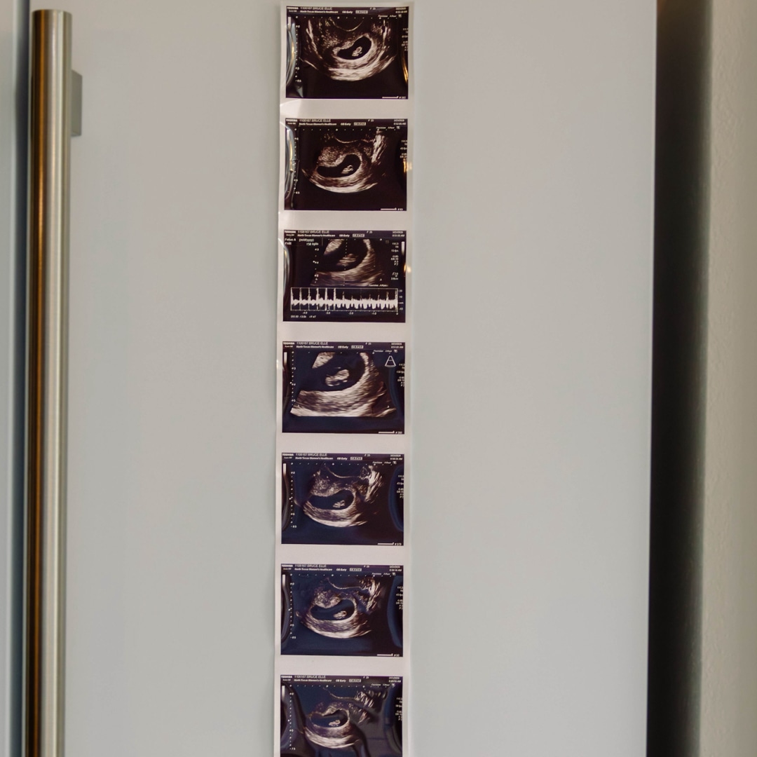 Photo shared by Elle for their Babylist baby registry.