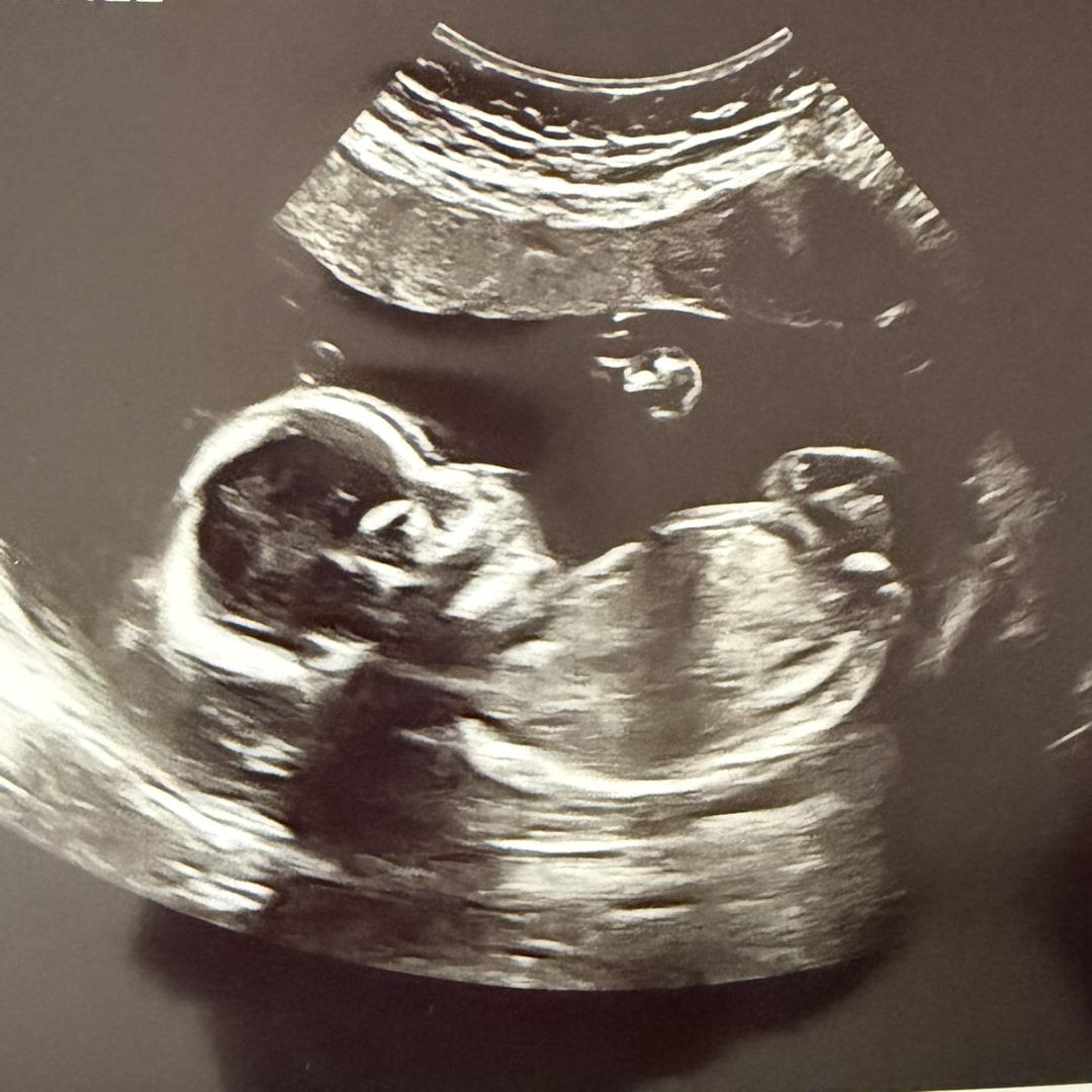 Photo shared by Florence for their Babylist baby registry.