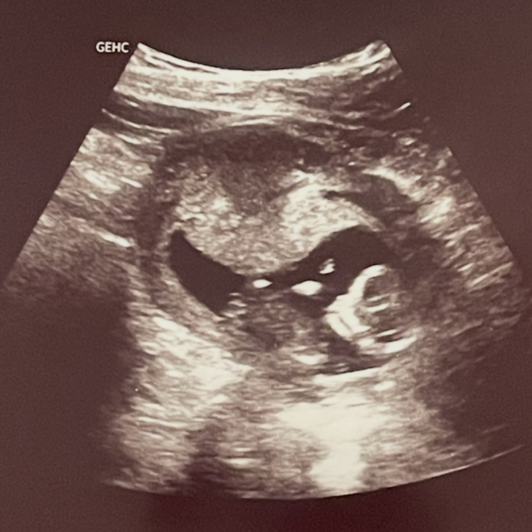 Photo shared by Sarah for their Babylist baby registry.
