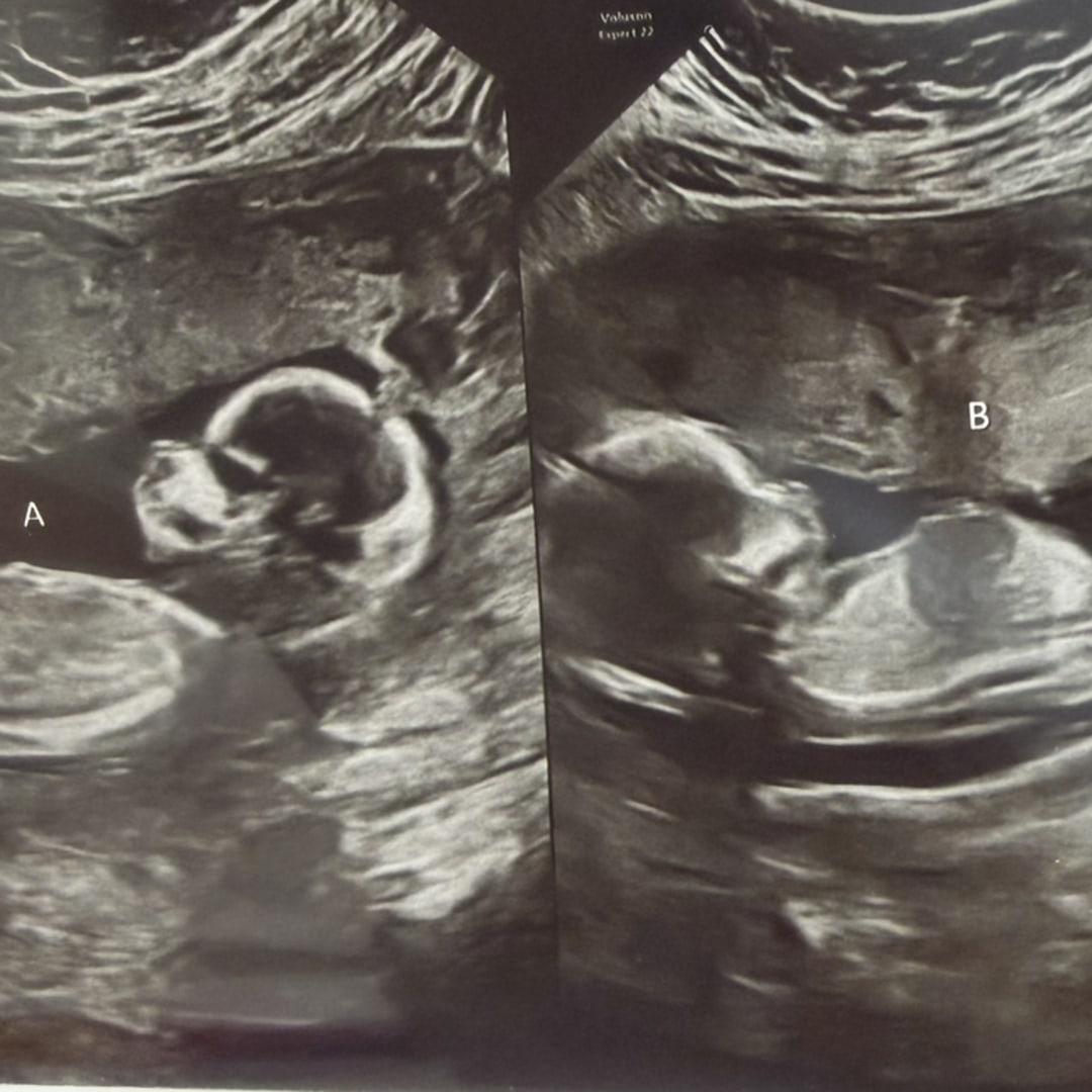 Photo shared by Morgan for their Babylist baby registry.
