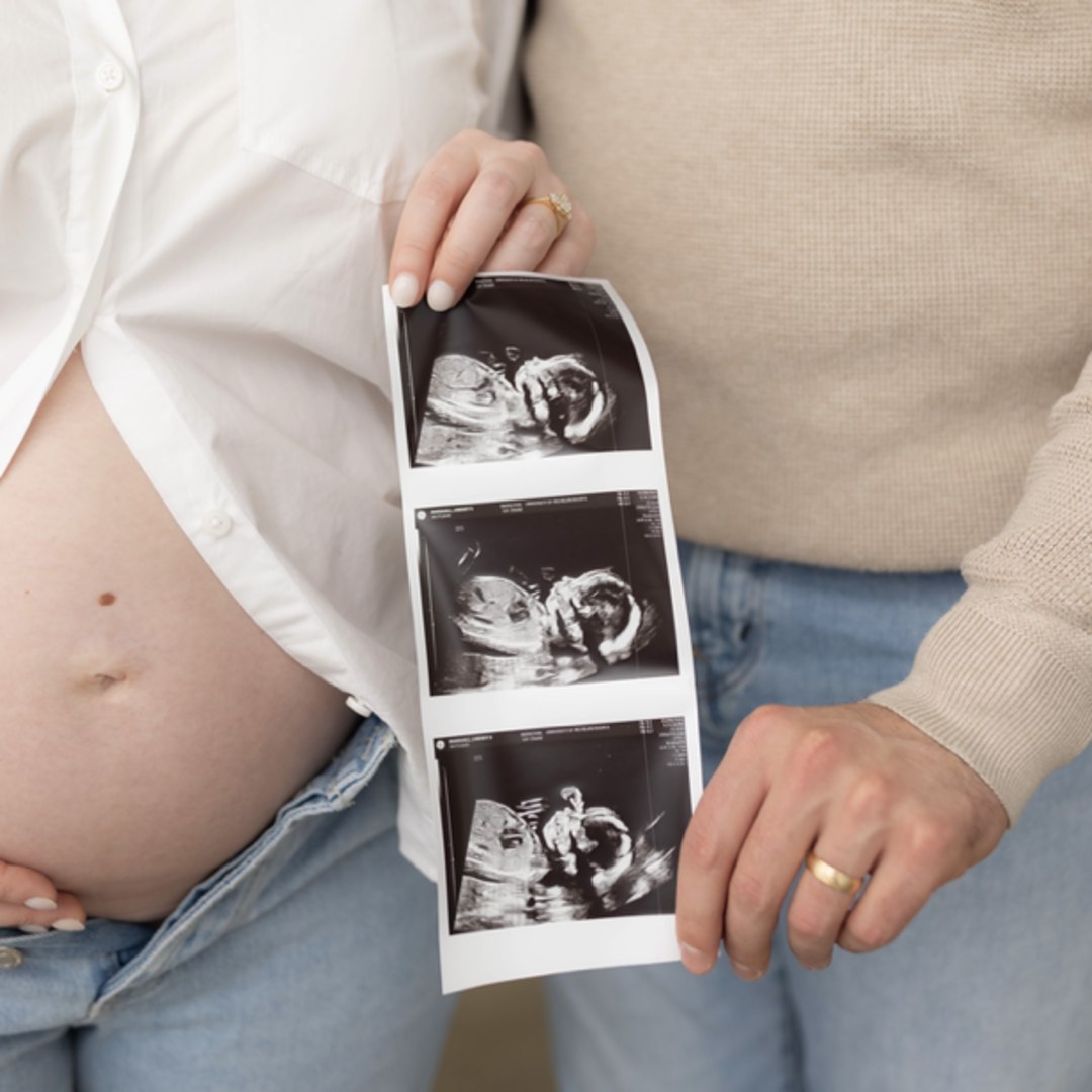 Photo shared by Lindsey for their Babylist baby registry.