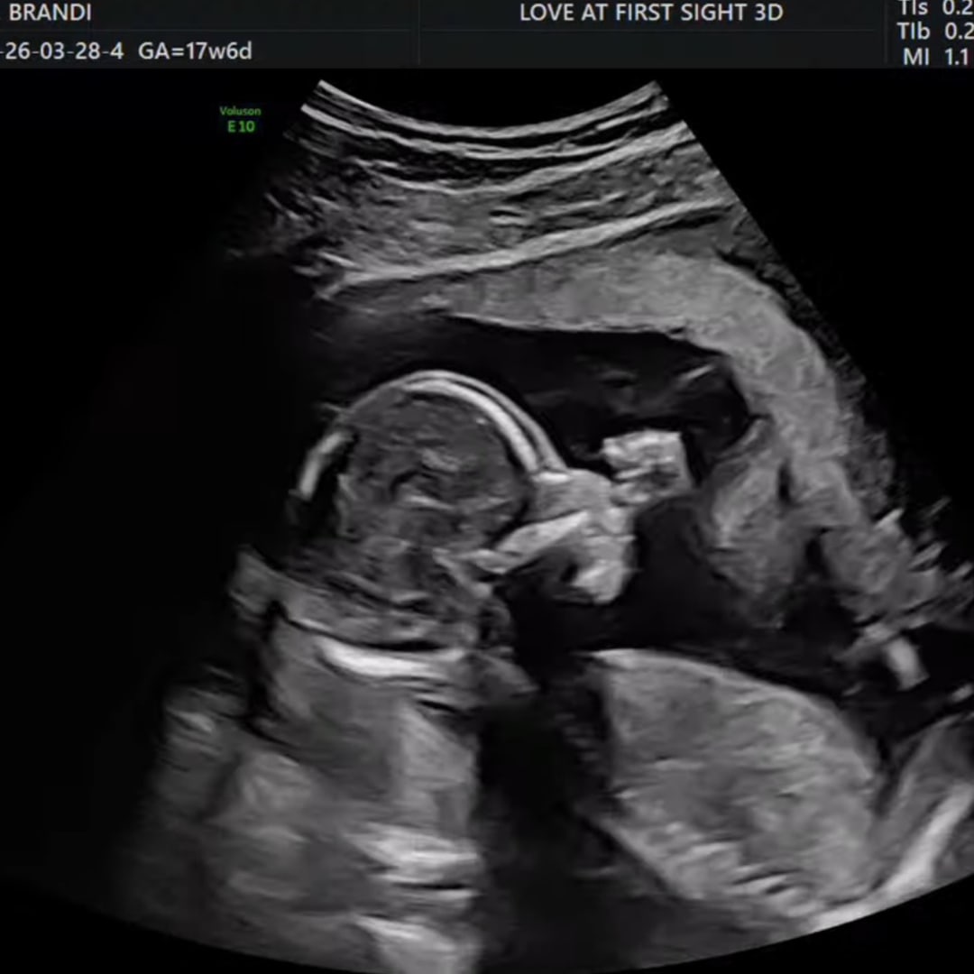 Photo shared by Brandi for their Babylist baby registry.