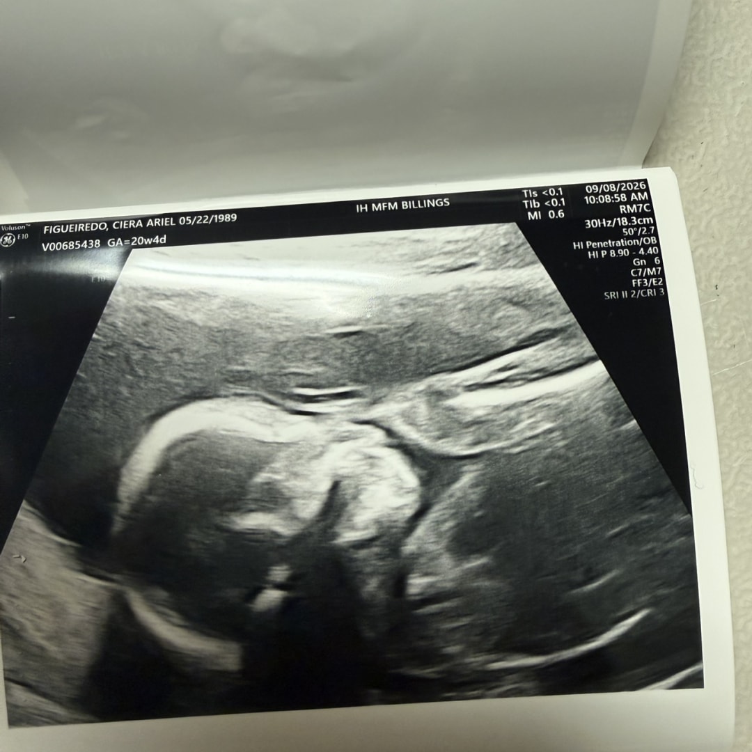 Photo shared by Ciera for their Babylist baby registry.