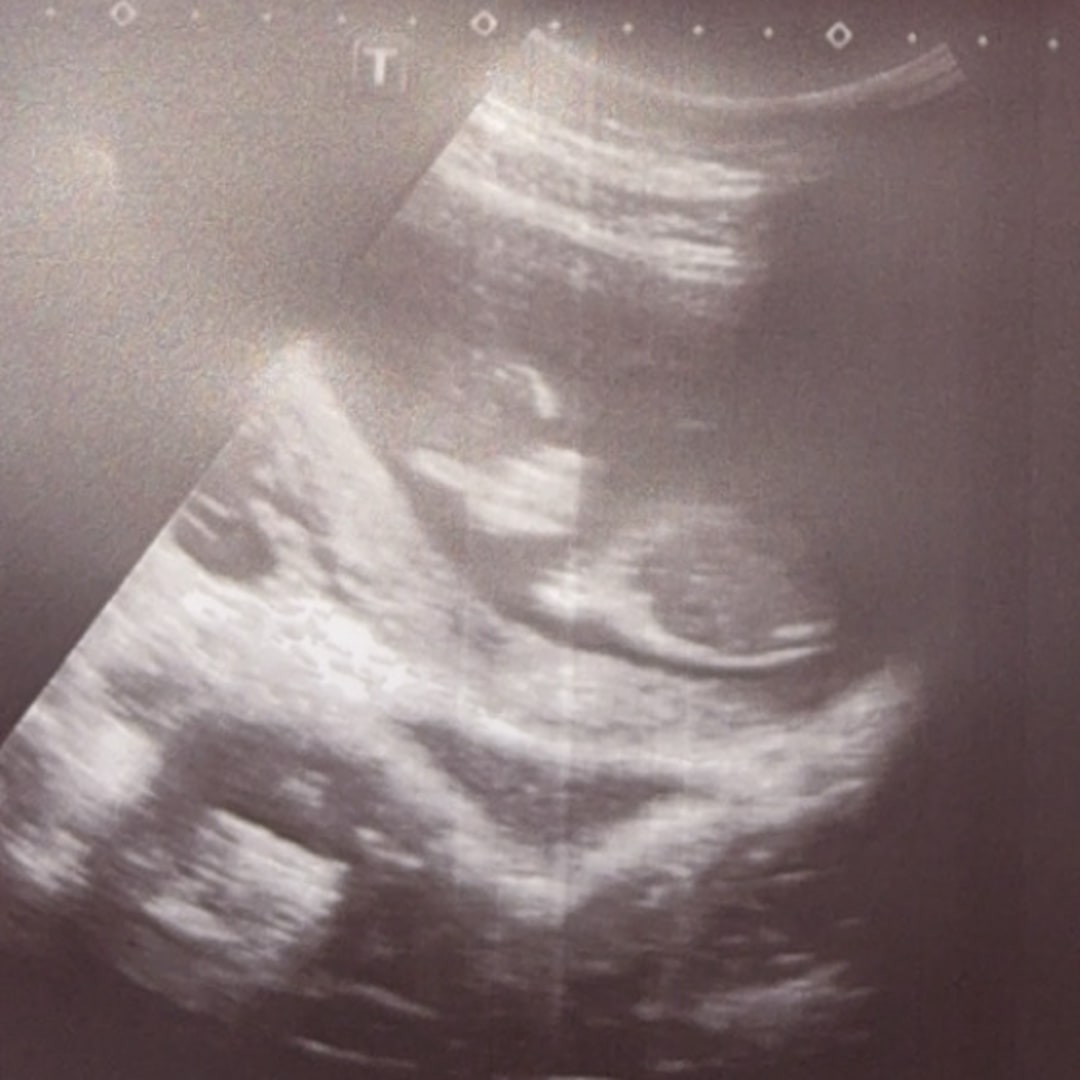 Photo shared by Kaitlin for their Babylist baby registry.