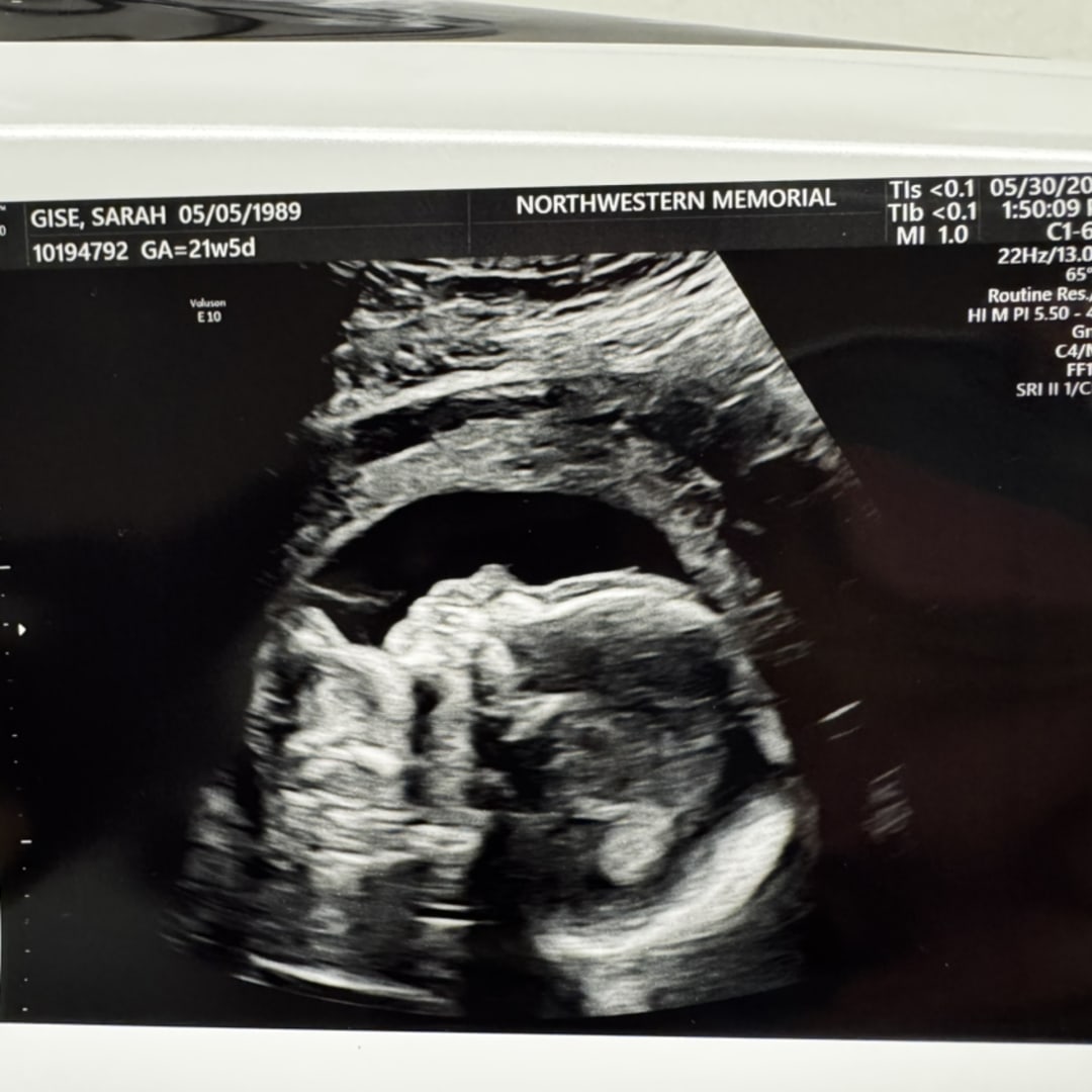Photo shared by Sarah for their Babylist baby registry.