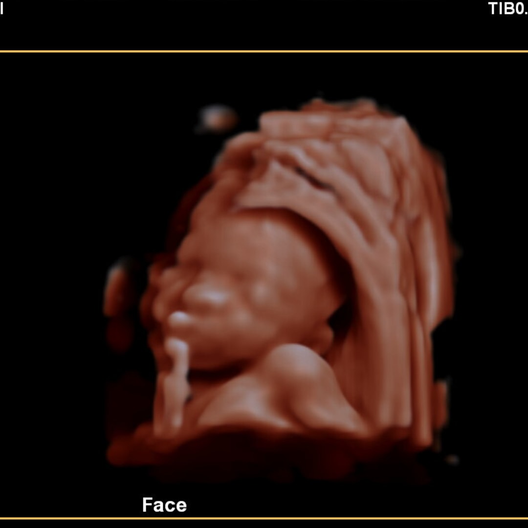 Photo shared by Ashley for their Babylist baby registry.