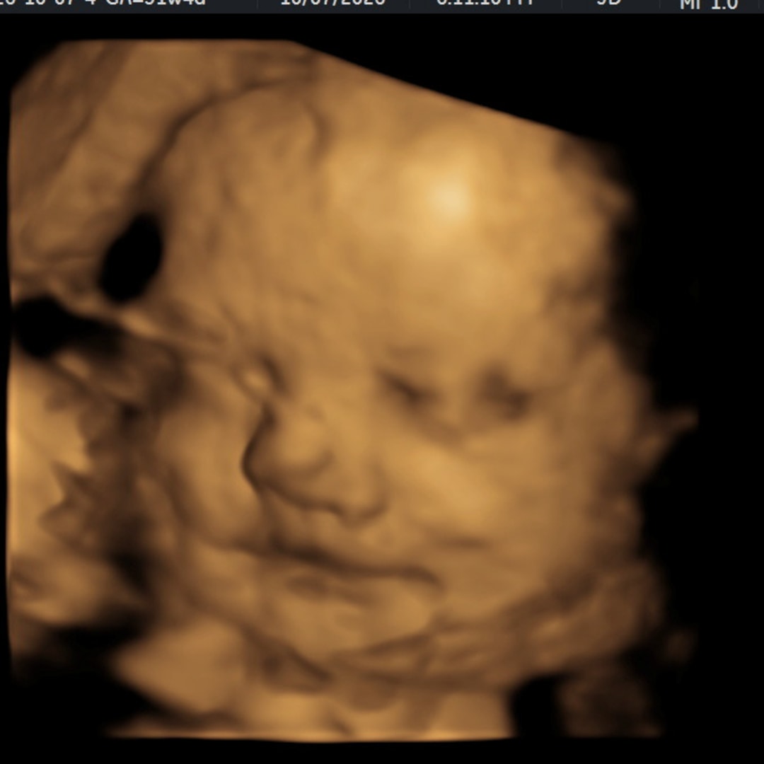 Photo shared by Ashley for their Babylist baby registry.