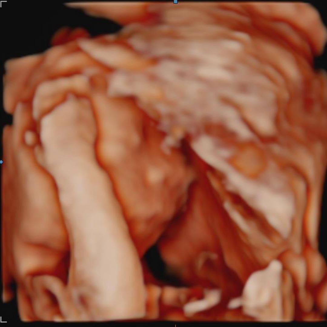 Photo shared by Mary for their Babylist baby registry.