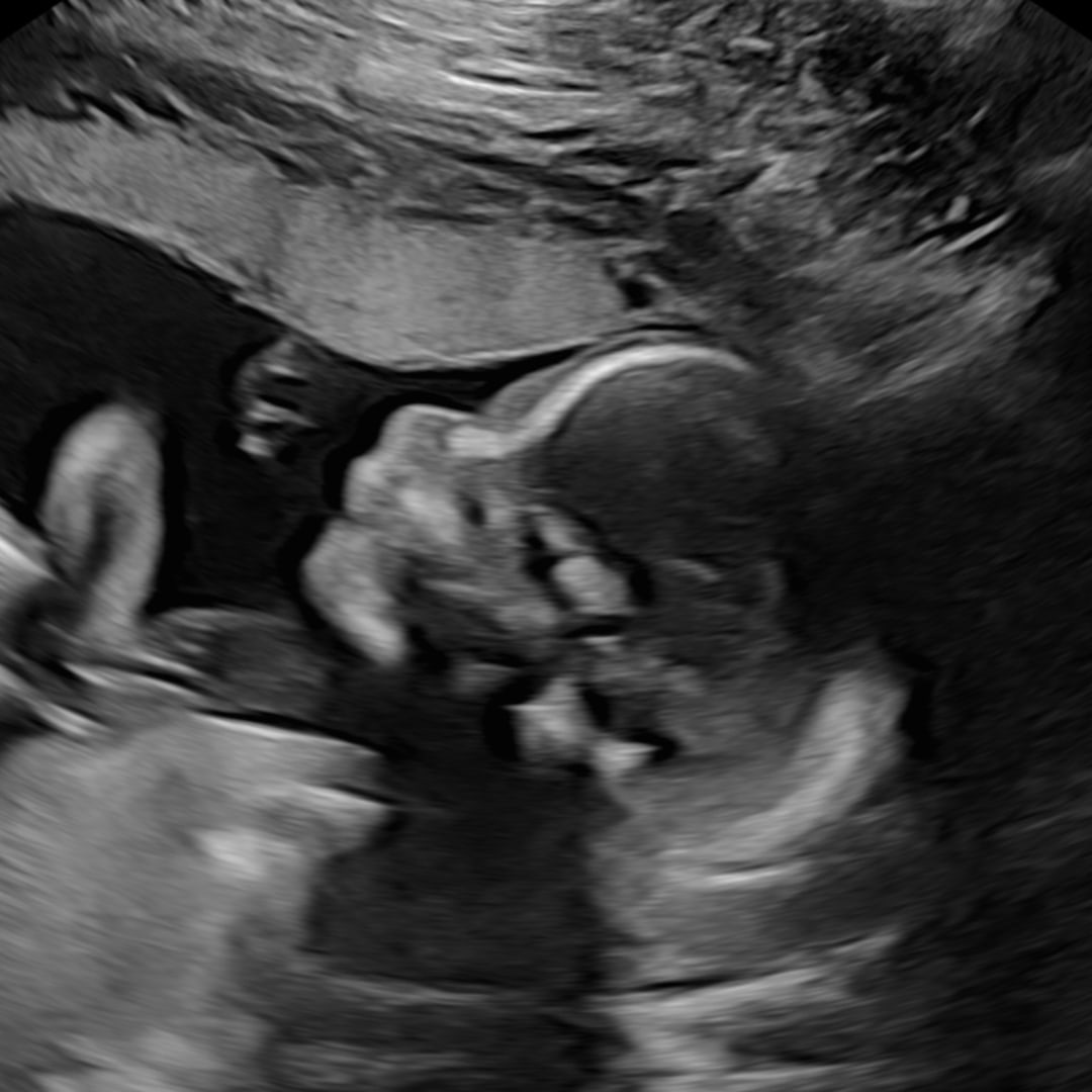 Photo shared by Reese for their Babylist baby registry.