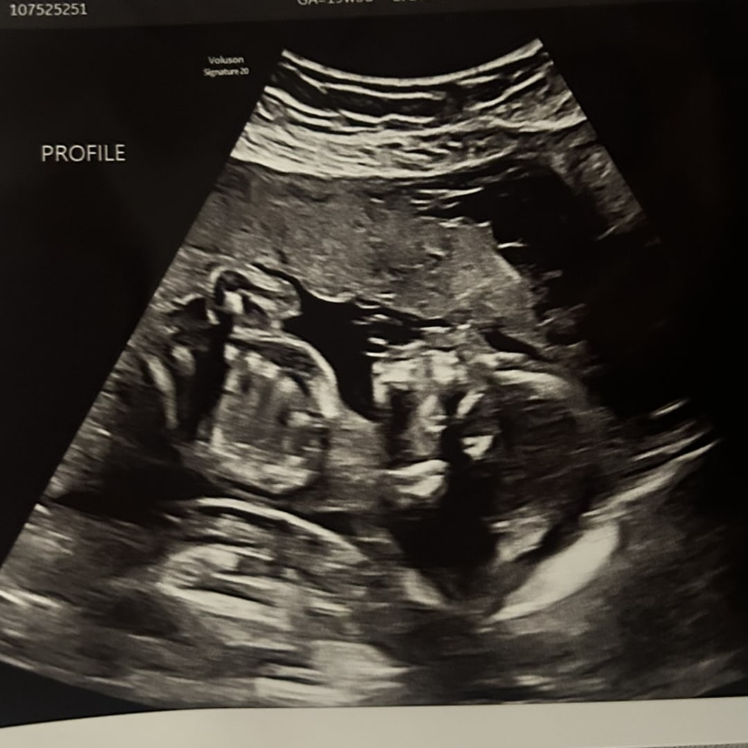 Photo shared by Olivia for their Babylist baby registry.