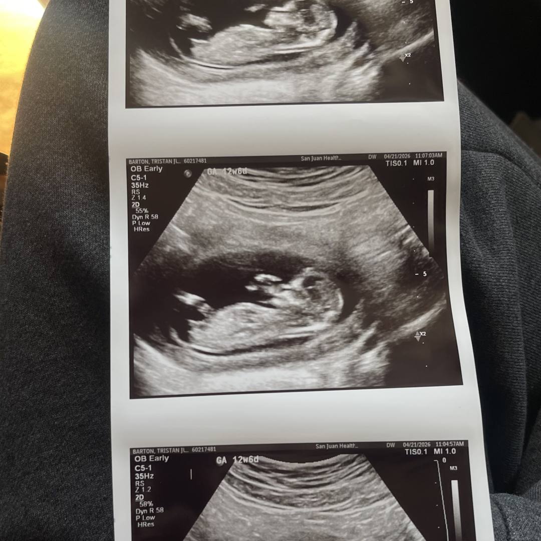 Photo shared by Tristan for their Babylist baby registry.