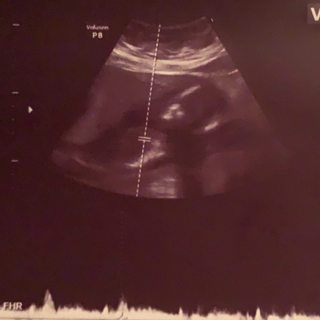 Photo shared by Beverly for their Babylist baby registry.