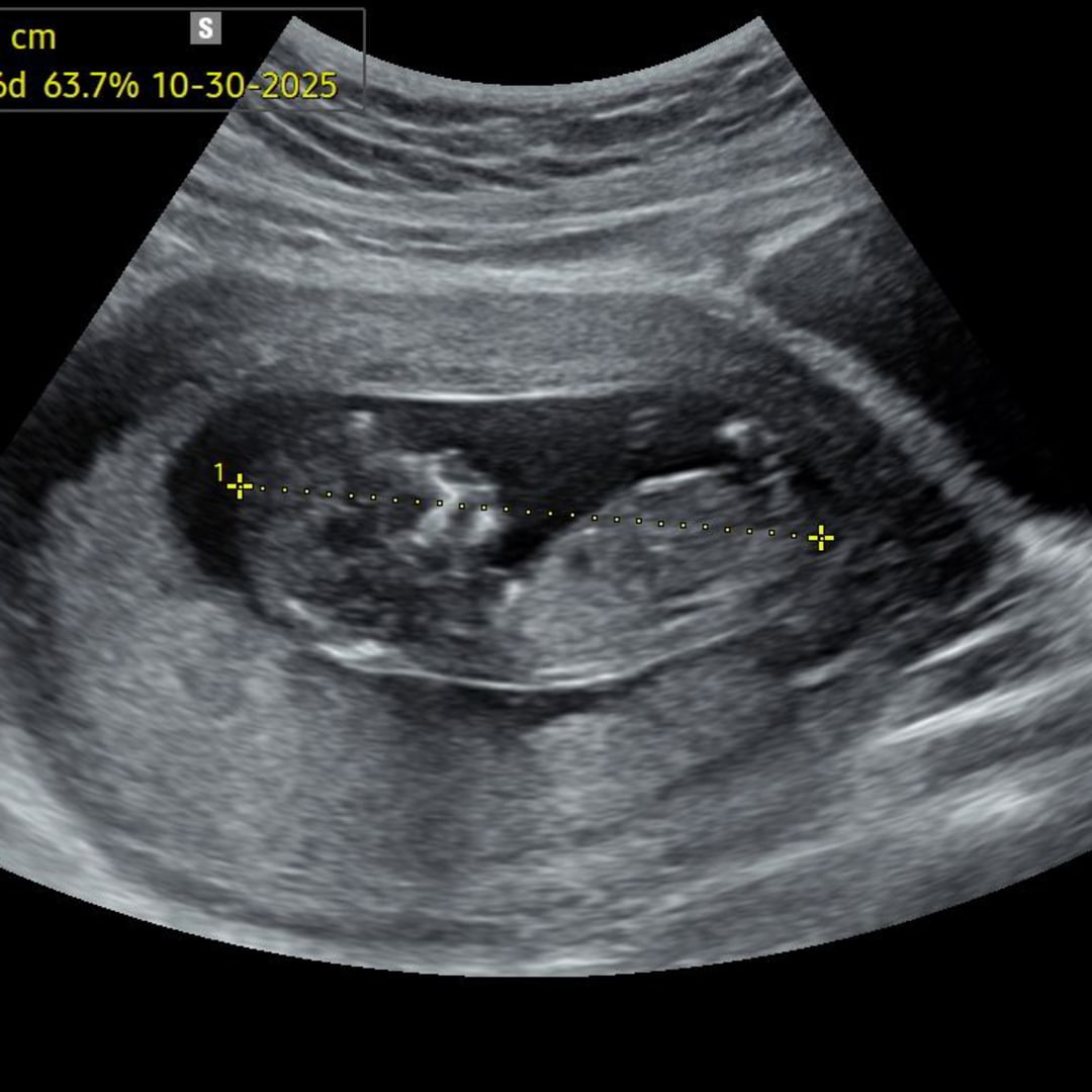 Photo shared by Jazlyn for their Babylist baby registry.