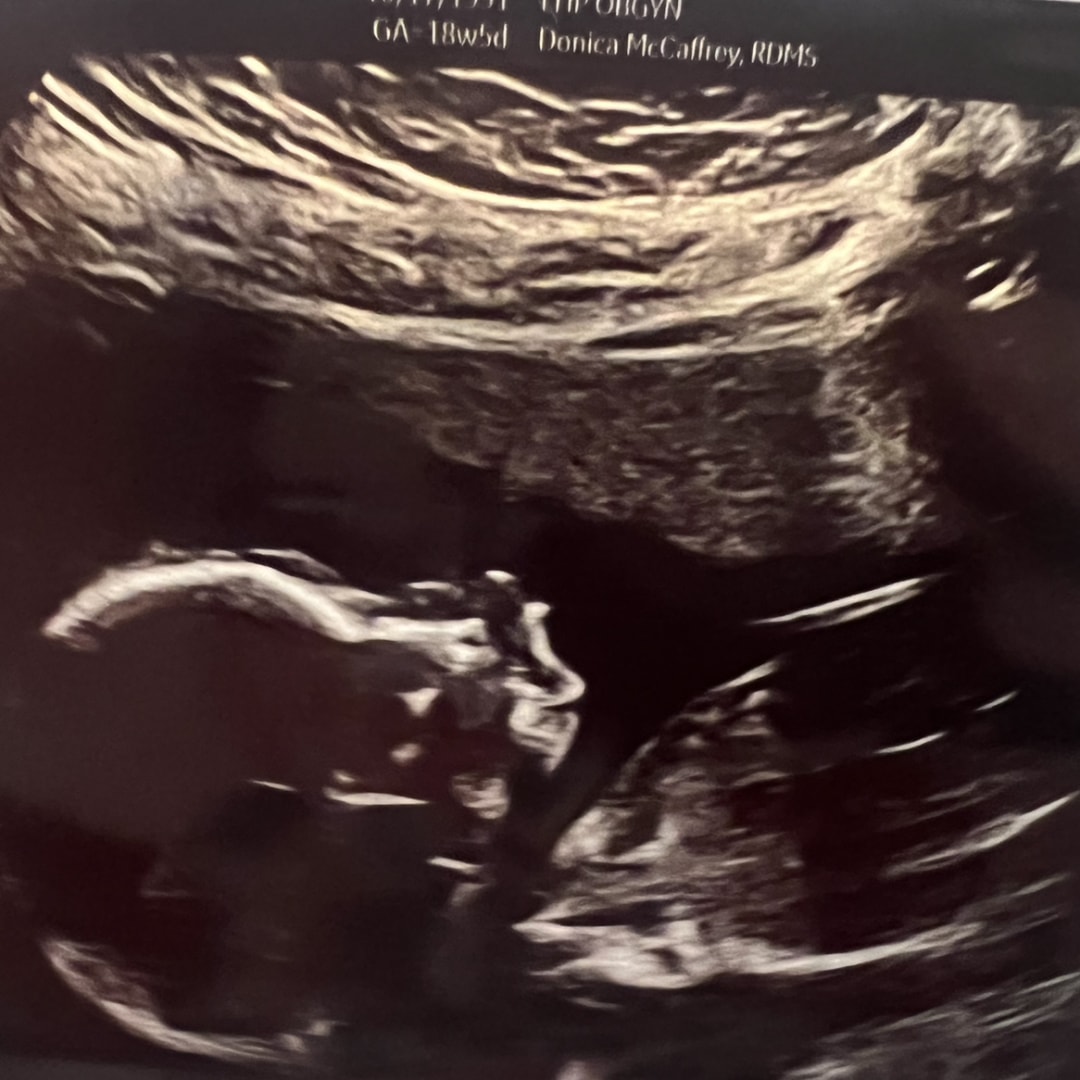 Photo shared by Desirae for their Babylist baby registry.