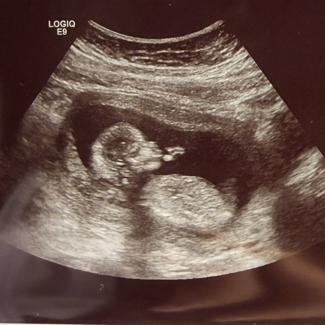 Photo shared by Kimberly for their Babylist baby registry.