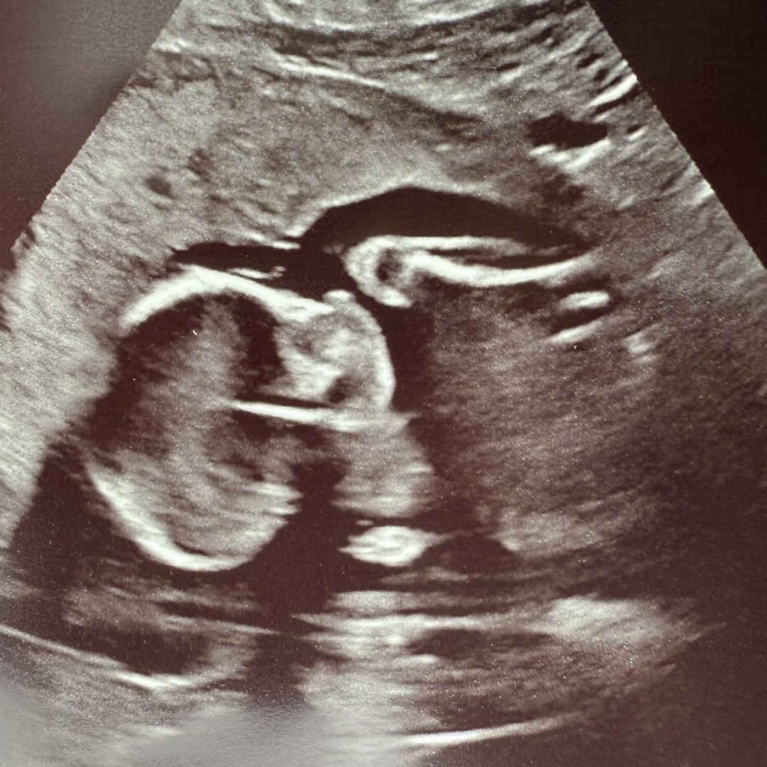 Photo shared by Stephanie for their Babylist baby registry.