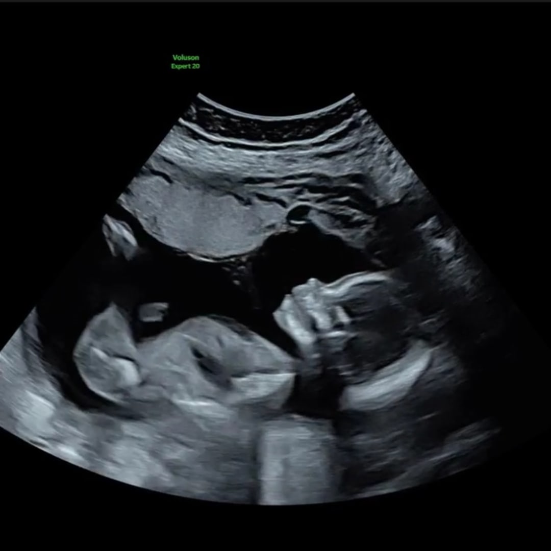 Photo shared by Bailey for their Babylist baby registry.