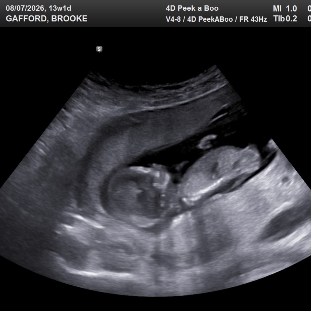 Photo shared by Brooke for their Babylist baby registry.