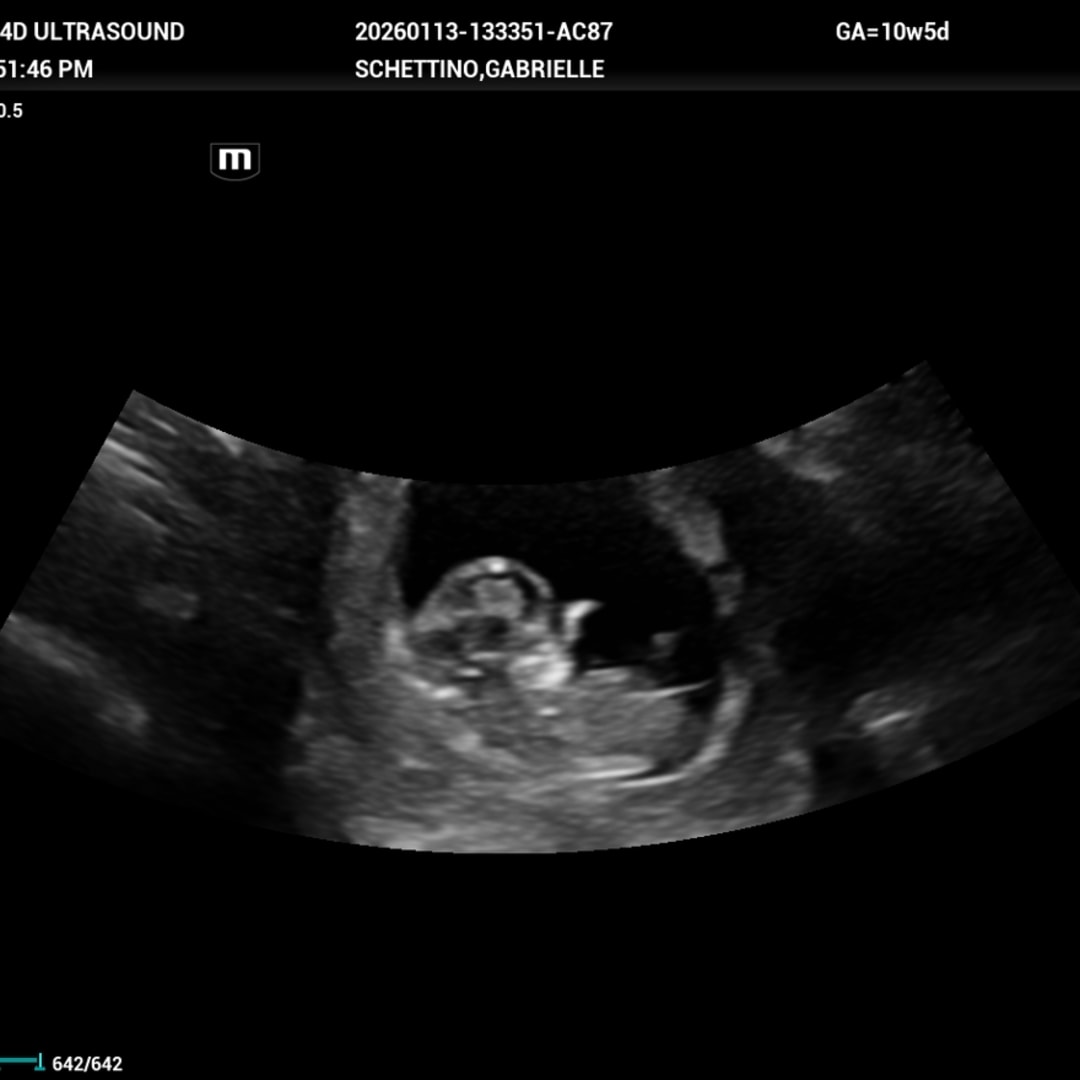 Photo shared by Gabrielle for their Babylist baby registry.