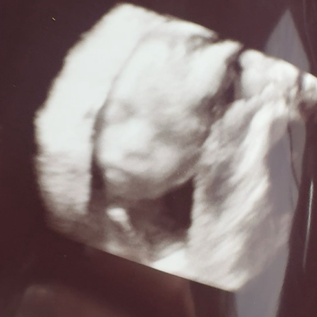 Photo shared by Katelyn for their Babylist baby registry.