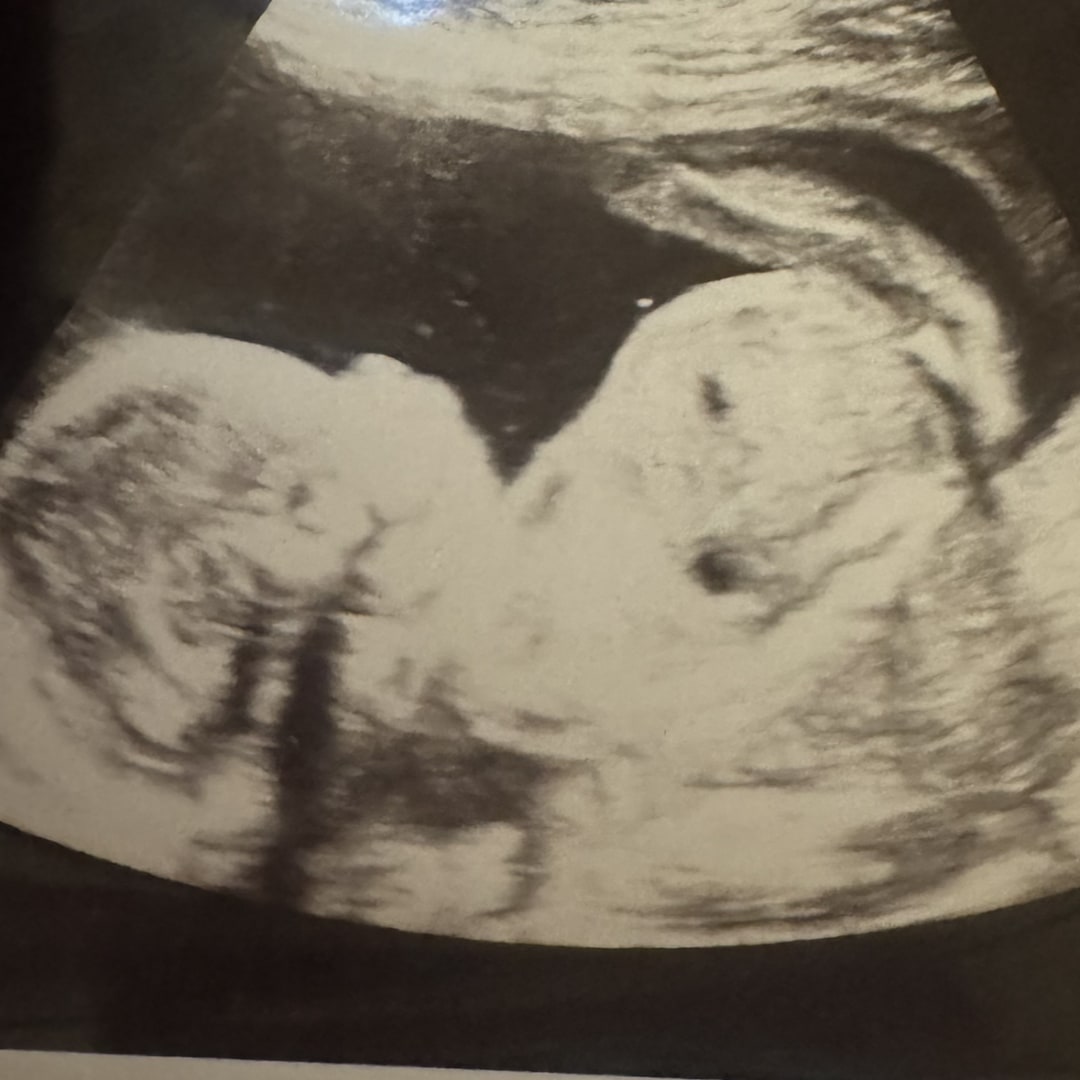 Photo shared by Shaderica for their Babylist baby registry.