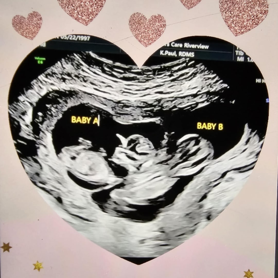 Photo shared by Julissa for their Babylist baby registry.