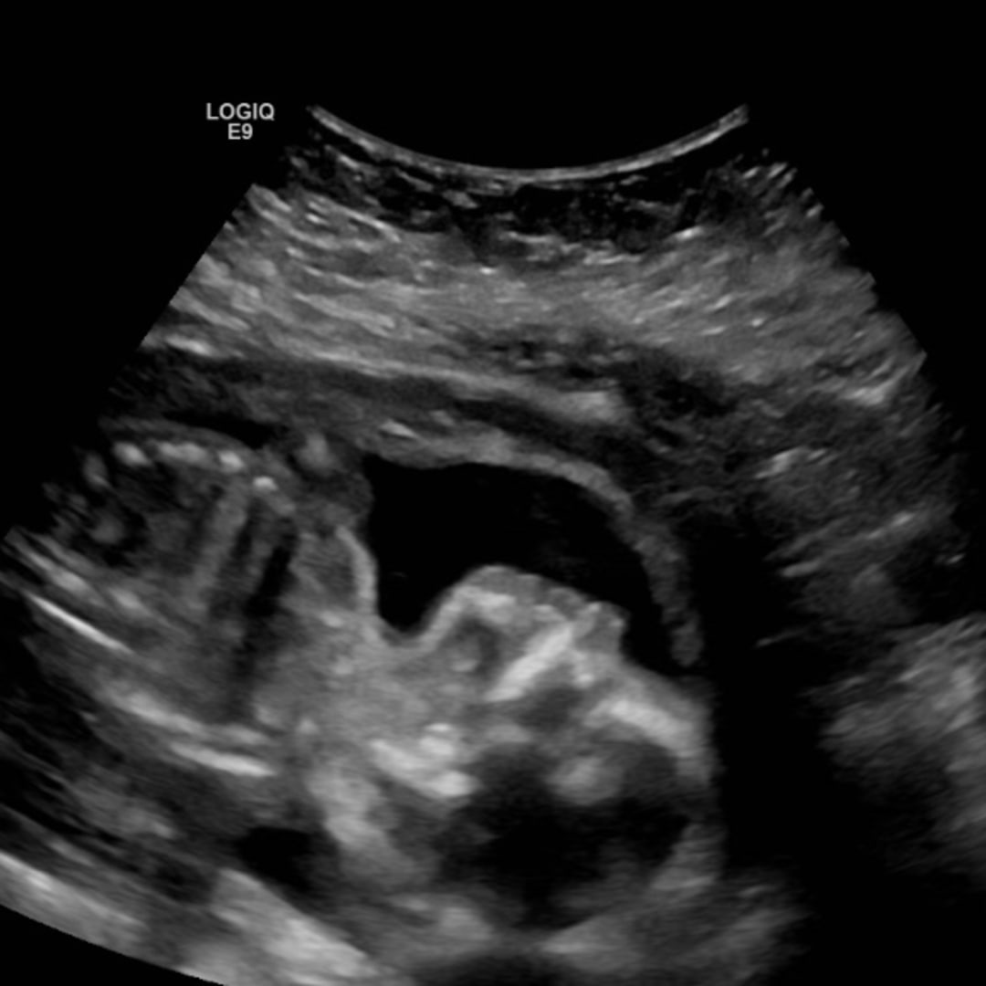 Photo shared by Chloe for their Babylist baby registry.
