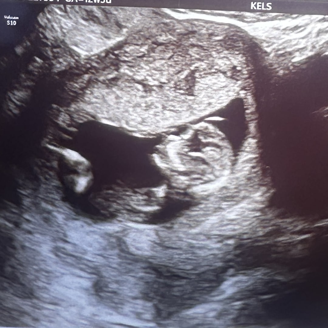 Photo shared by Alexa for their Babylist baby registry.
