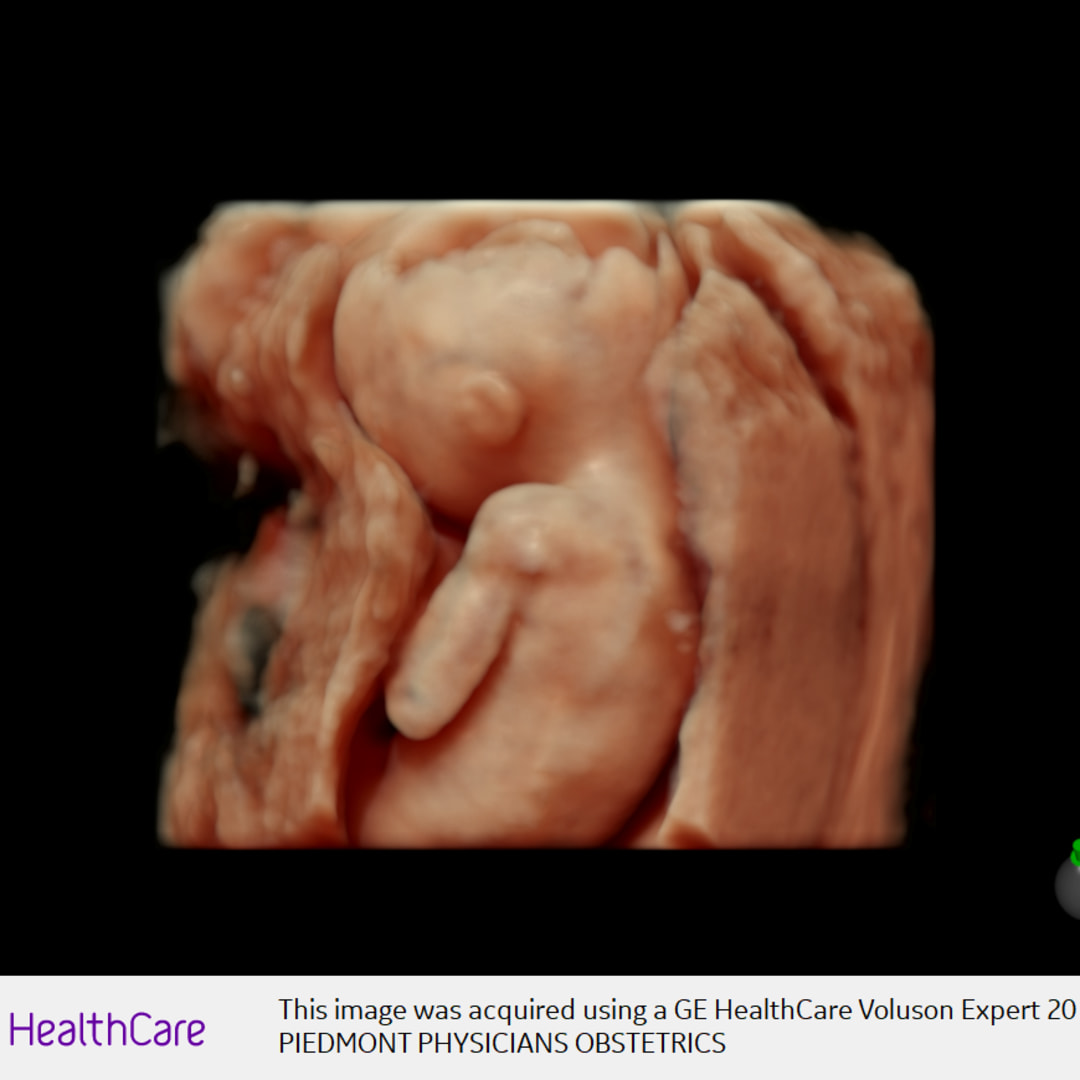 Photo shared by Itzanami for their Babylist baby registry.