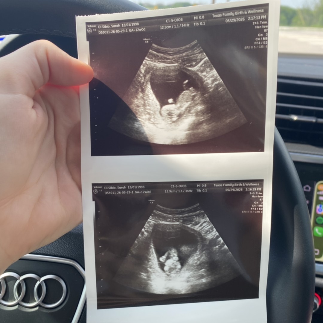 Photo shared by Sarah for their Babylist baby registry.