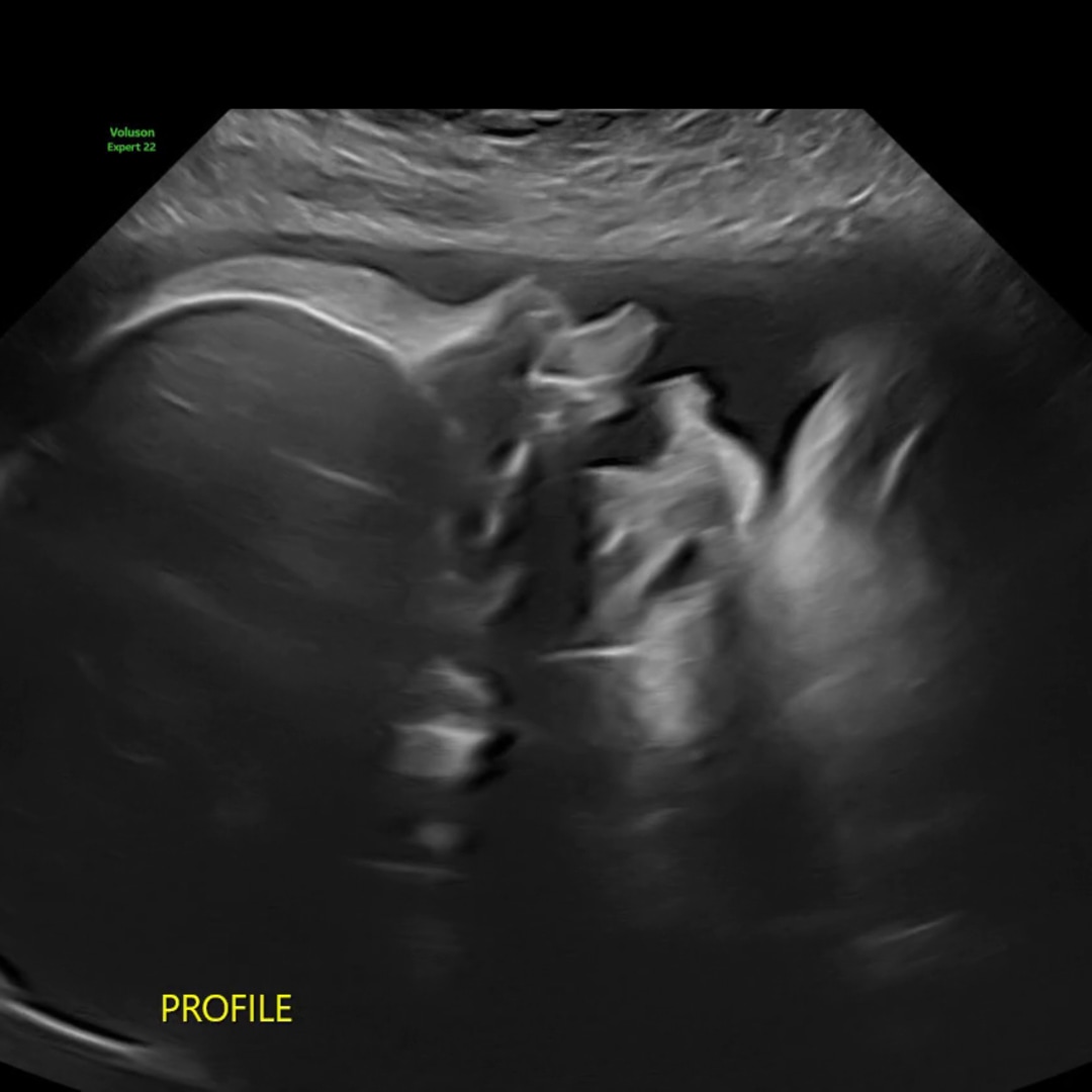 Photo shared by Jareli for their Babylist baby registry.