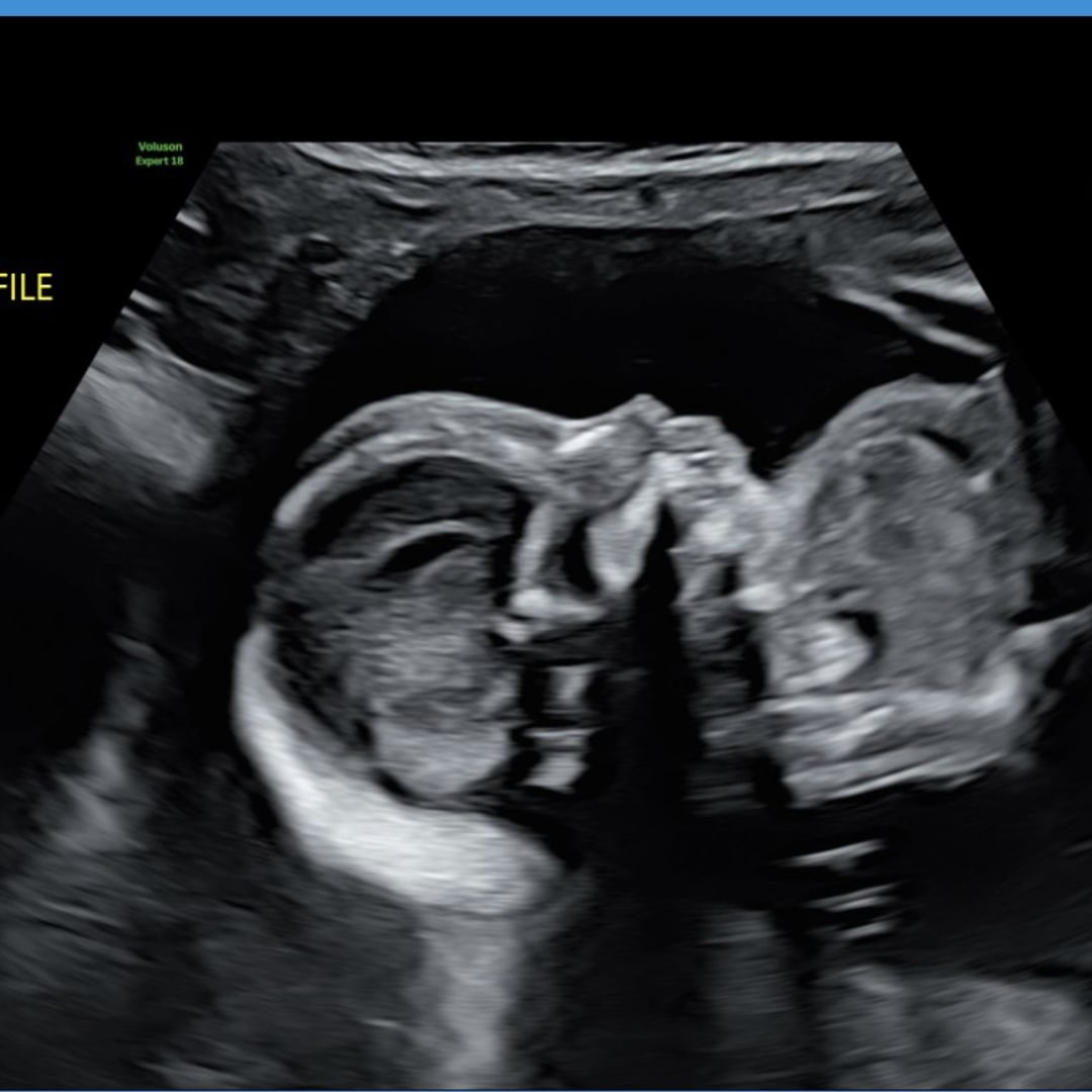 Photo shared by Peydon for their Babylist baby registry.