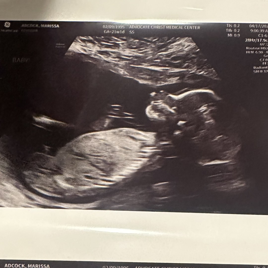 Photo shared by Marissa for their Babylist baby registry.