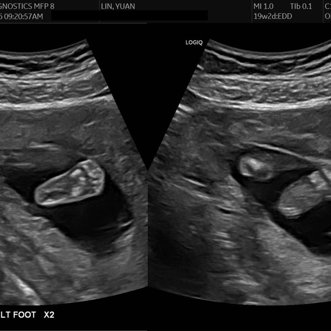 Photo shared by Yuan for their Babylist baby registry.