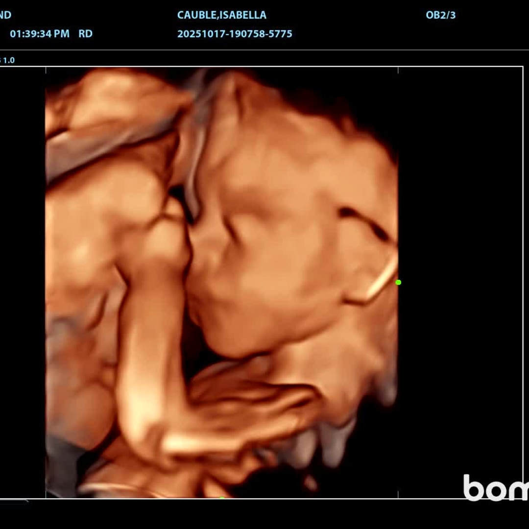 Photo shared by Isabella for their Babylist baby registry.