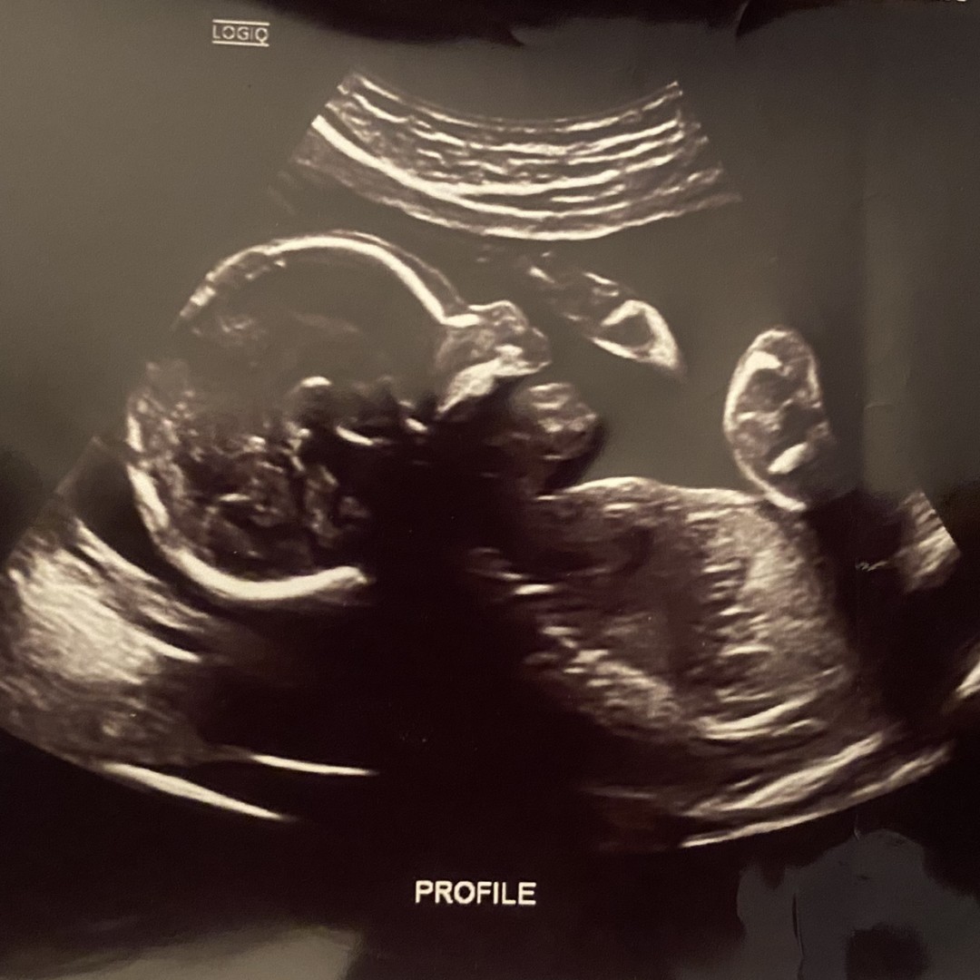 Photo shared by Elisha for their Babylist baby registry.