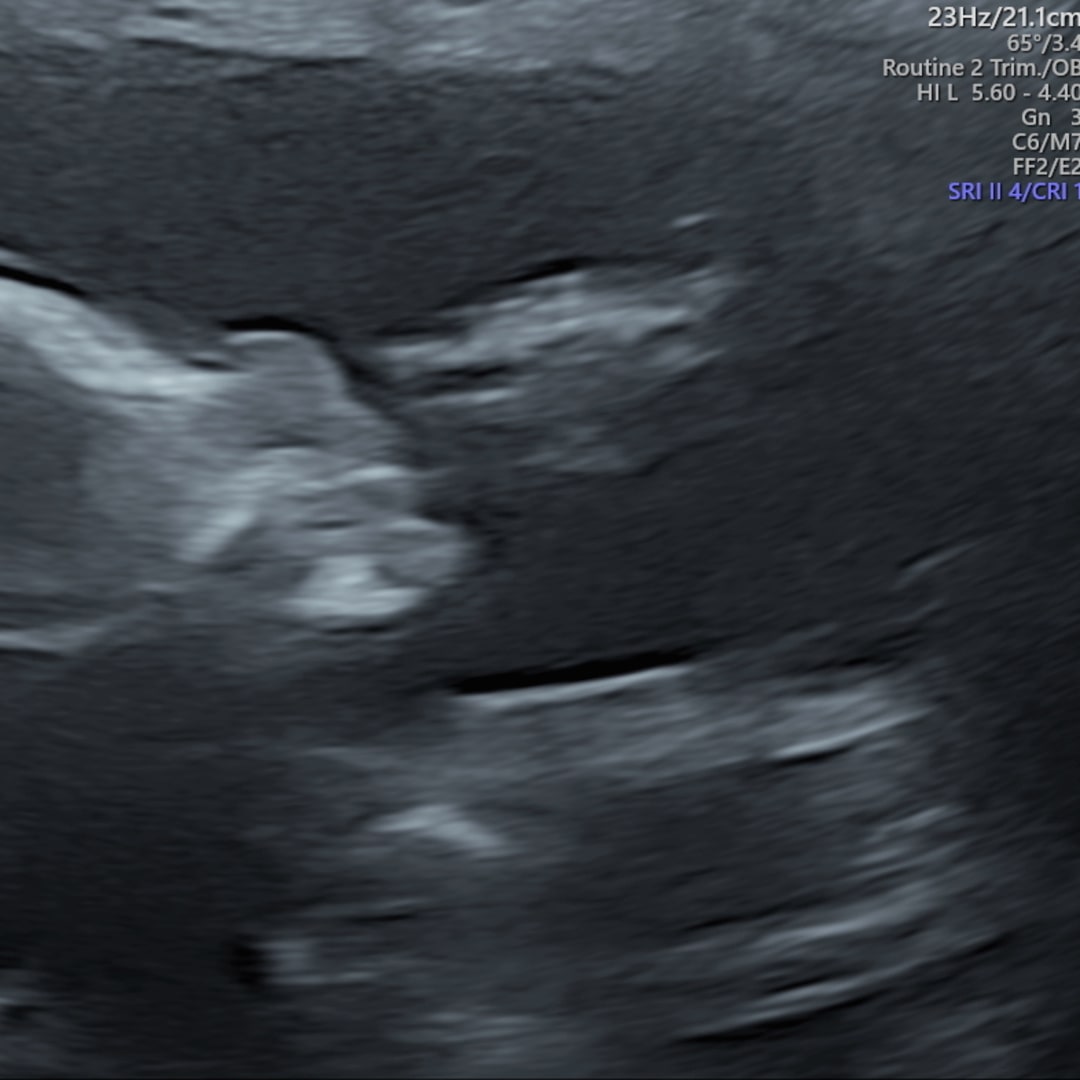 Photo shared by Orianah for their Babylist baby registry.