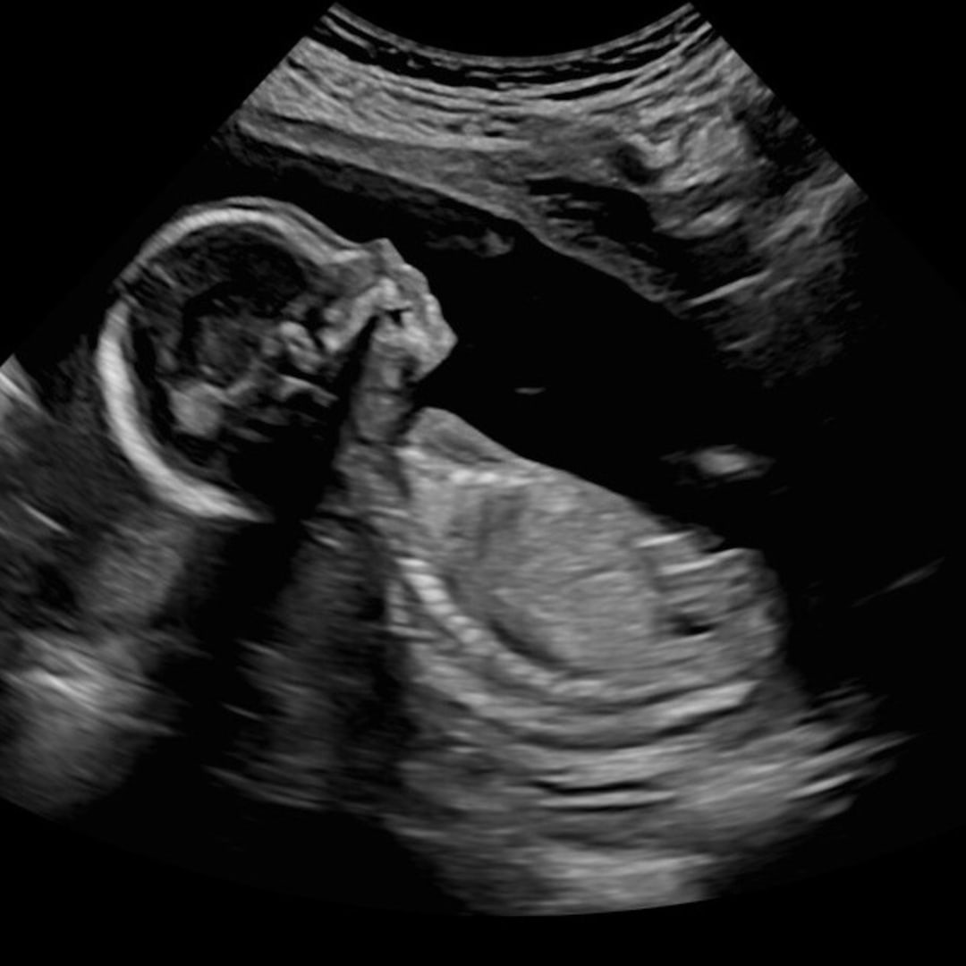 Photo shared by Alexis for their Babylist baby registry.