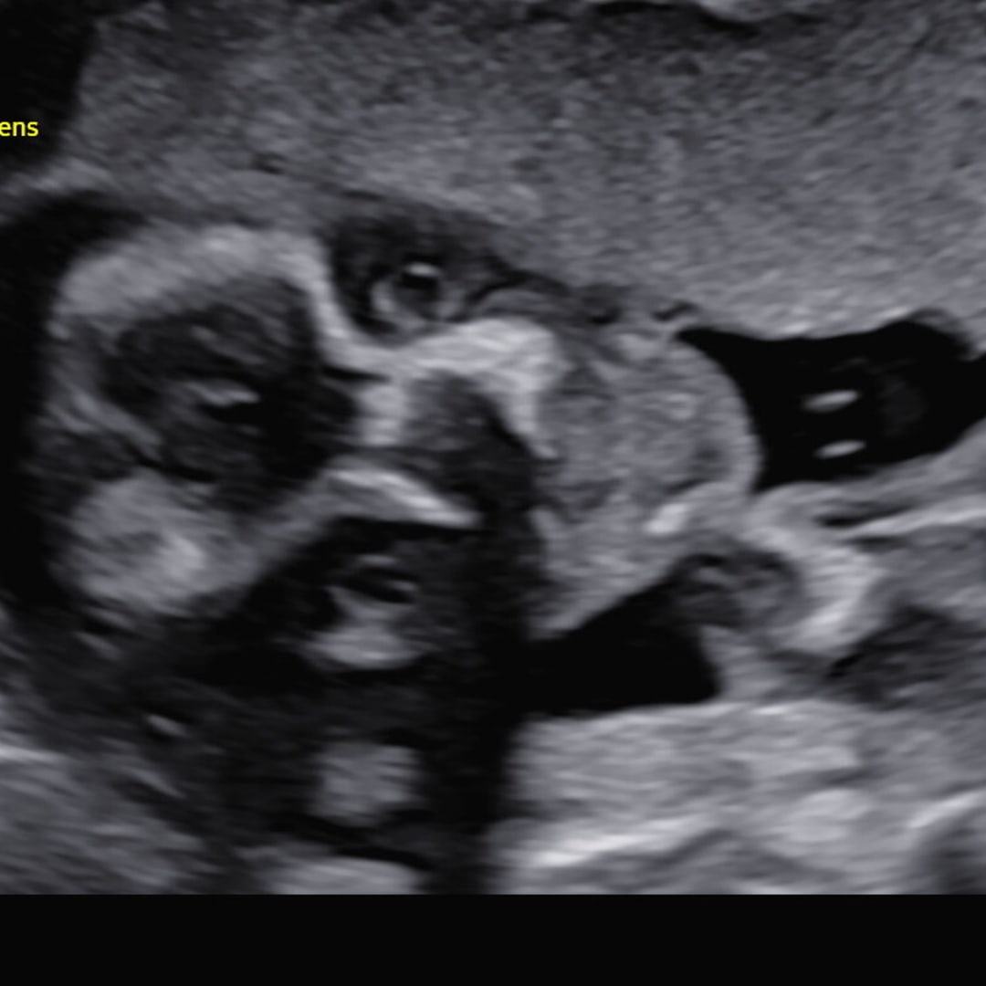 Photo shared by Rebecca for their Babylist baby registry.