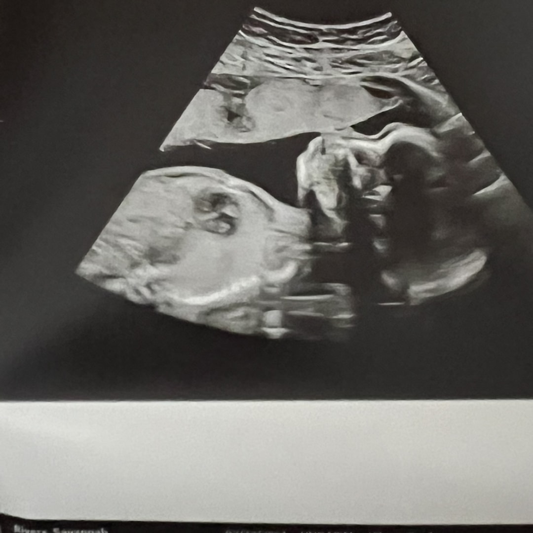 Photo shared by Savannah for their Babylist baby registry.